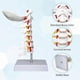 thumbnail image 2 of Model of cervical spine, lifesize with vertebrae, nerves and occipital plate, 2 of 5