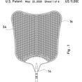 thumbnail image 3 of Matamoscas, matamoscas manuales flexibles, juego resistente, matamoscas de plástico extensible con mango de acero inoxidable para interiores y exteriores (paquete de 2), 3 of 4