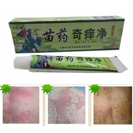 Psoriasis Treatment,Psoriasis Cream for Dermatitis, Eczema,Natural Chinese Herbal Cream Eczema Dermatitis Psoriasis Vitiligo Skin Disease