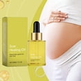 thumbnail image 2 of NEW Essential oils Essential Oil Beauty Removal Scar Premium Compound Oil Cells Reduces Scar Resists Acnes 30ml(buy 2 get 10% off), 2 of 5