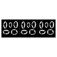 thumbnail image 1 of Toystoory Mold Cookie Irregular Underwear Shape Biscuit Chocolate Stamp Jelly Bakeware Craft Home Moulds Fondant Cake Decoration Type1, 1 of 6