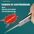 thumbnail image 3 of Pimple Extractor Tools,Blackhead Remover,Pimple Popper,Acne Removal Kit Risk Free Treatment,Whitehead Popping,Blackhead Tweezers, 3 of 9