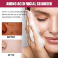 thumbnail image 3 of Limpiador facial OUHOE, limpieza facial de poros, hidratante, humectante, suave, refrescante, reafirmante de la piel, limpiador facial BF | |, 3 of 5