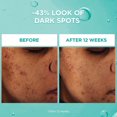 thumbnail image 2 of Bright Reveal Niacinamide Face Serum, With Ferulic + Amino Sulfonic Acids, 2 of 8