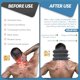thumbnail image 3 of Dispositivo de tracción cervical para aliviar el dolor de cuello. Collarín inflable ajustable y aparato de tracción cervical. Dispositivo de descompresión cervical para uso doméstico (gris oscuro)., 3 of 7