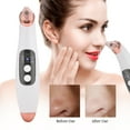 thumbnail image 2 of Electric Pore Cleanser, Six Suction Heads Remove Pimples Instrument  For Skin, 2 of 8