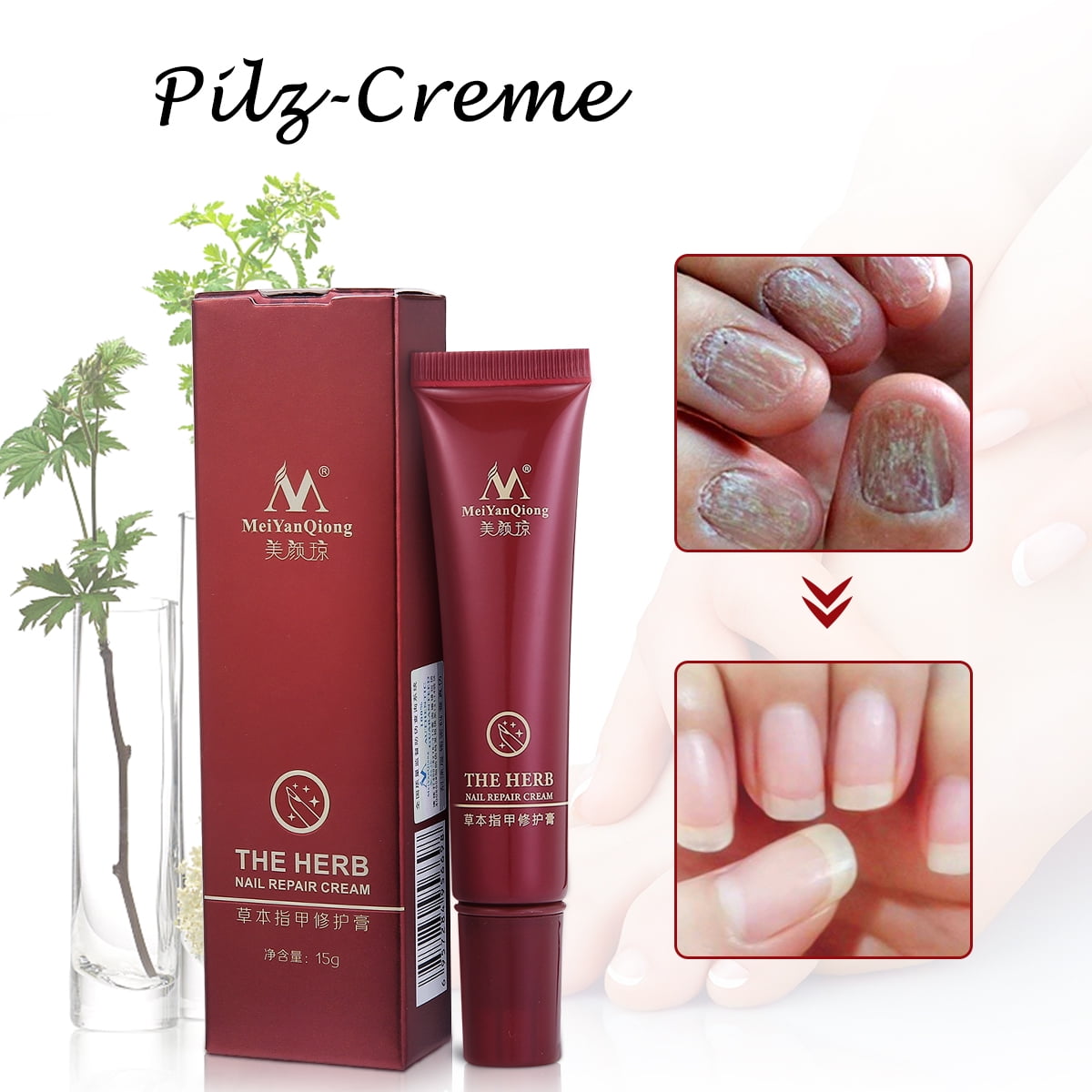 Foot Nail Repair Ointment Nail Fungus Treatment Herb Anti Fungal Nail