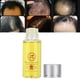 thumbnail image 5 of Aceite esencial para el crecimiento del cabello Sincero Tratamiento para la caída del cabello 20 ml, 5 of 10