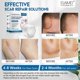 thumbnail image 4 of Silicone Scar Sheets, 2.5cmx1.5m Clear Scar Tape, Silicone Scar Strips, Invisible Silicone Scar Sheets for C-Section, Surgery, 4 of 5