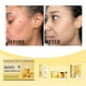 thumbnail image 4 of Fiudx Ofertas flash del día solo en línea Set Hidratante Mieles Nutritivas Limpia, mejora la aspereza y exfolia suavemente 30 ml, 4 of 7