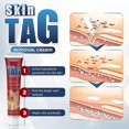 thumbnail image 4 of 1/2Pcs Skin Tag Removal Cream Moles Acne Scar Wart Treatment Remover Herbal Safe, 4 of 4