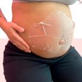 thumbnail image 3 of Genovie MD Maternal Miracle Patchs pour Marques Extensibles, 3 of 8