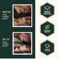 thumbnail image 7 of VetriScience Healthy Mouth, Dental Health Powder for Cats and Dogs, Unflavored, 4.2 oz., 7 of 7