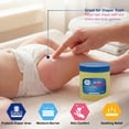 thumbnail image 4 of MEDPRIDE Baby Petroleum Jelly Large Tub 8 Oz – Skin Protectant & Moisturizer for Dry Skin, Diaper Rash, Baby Scented Petroleum Jelly, 4 of 7