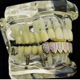 thumbnail image 3 of Pink CZ Grillz 2-Tone 14K Gold Plated With Silver Tone Cubic Zirconia Bling Bottom Lower Teeth Hip Hop Grills, 3 of 5