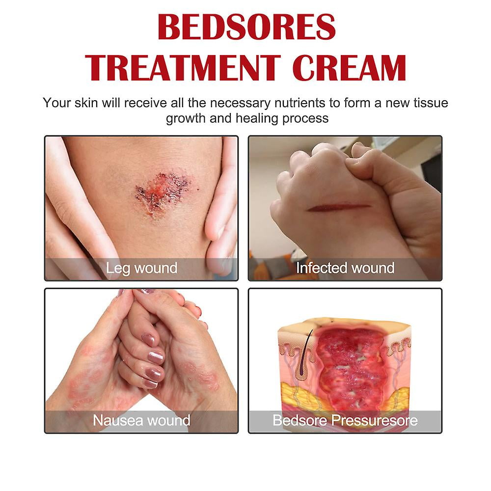 3x Bedsore Treatment Cream Pressure Sore Ulcer Skin Rot Necrotic Repair Relief Ointment Bed Sore Wound Healing Decubitus Feet Care