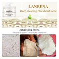 thumbnail image 2 of Crema para eliminar puntos negros con tiras para los poros, mascarilla de barro despegable para tratamientos de cuidado de la piel y limpieza de la nariz contra el acné a base de plantas, 2 of 6
