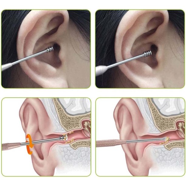 Juego de tapones para los oídos y herramientas de cera, con un cubo de almacenamiento para recoger los oídos, fácil de usar, juego de herramientas profesionales de limpieza de oídos de 6 piezas para adultos, hombres y mujeres ZefeiWu 1327534192551