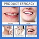 thumbnail image 2 of Silicone Relinedenture Set, Denture Reline Kit, Denture Set, 2 of 5