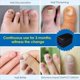 thumbnail image 5 of Dispositivo de Luz para Limpieza de Hongos en las Uñas, Tratamientos para Hongos en las Uñas para Onicomicosis, Luz Altamente Efectiva para Uñas de Manos y Pies B, 5 of 5