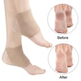thumbnail image 2 of Heel Socks Protective Soft Breathable Open Toe Gel Heel Socks for Cracked Feet, 2 of 6