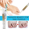 thumbnail image 2 of B Lápiz reparador de uñas con luz azul, tratamiento de hongos para uñas, crema nutritiva, antirestauración de uñas de los pies saludables, reparación de infecciones por hongos, 2 of 5