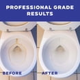 thumbnail image 3 of Don Aslett's Complete Toilet Cleaning Set | Includes 32 oz Toilet Cleaner, Convenient Cleaning Caddy, Johnny Mop Toilet Brush, and Pumice Stone for Tough Stains, 3 of 7