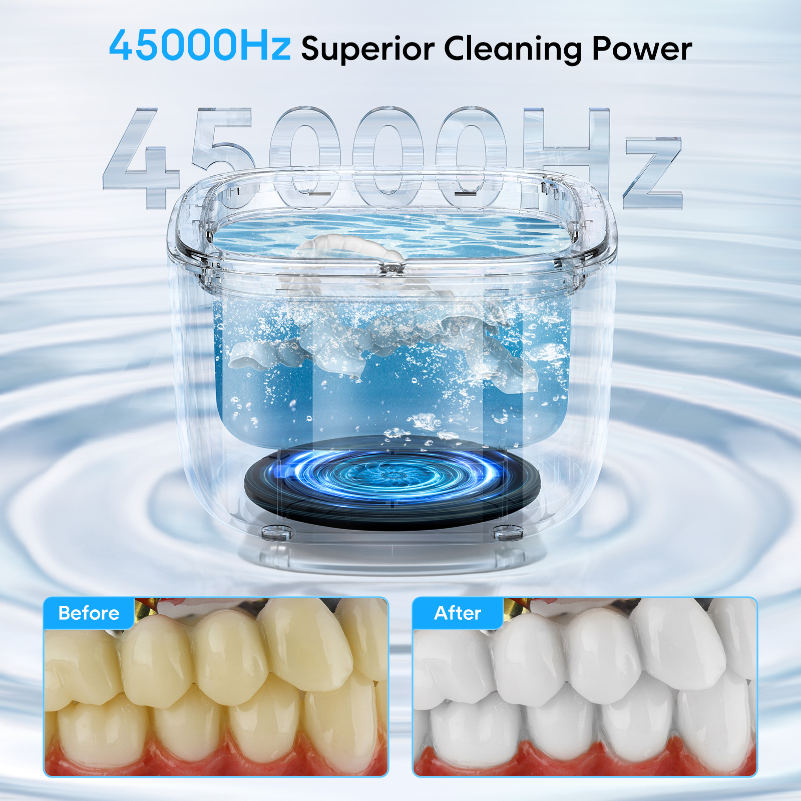 Ultrasonic Teeth Cleaner, 43kHz 255ML Ultrasonic Tooth Tray Cleaner, Ultrasonic Cleaner for Tooth Trays, Dental Guards, Flossing, Whitening Trays, Toothbrush Heads,...