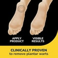 thumbnail image 4 of Dr. Scholl's Clear Away Plantar Wart Remover (24 Discs/24 Cushions), 24 Treatments, 4 of 11