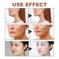 thumbnail image 4 of Qarigey Cinta de estiramiento facial para apretar la cara de las mejillas, cinturón de belleza antiarrugas para levantar la cara, parche de Tratamientos faciales, 4 of 6