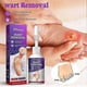 thumbnail image 2 of 3pcs Corn Removal Extra Strengthen Gel Foot Callus Removal Treatment Hard Skin, 2 of 5