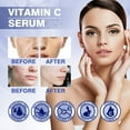 Vitamin C Facial Fine Lines Around The Eyes Moisturizing Moisturizing