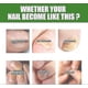 thumbnail image 5 of 2pcs South Moon Nail Care Roller Balls - Nourishing Massage For Stronger, Fast-Growing Nails With 7-day Nail Growth Formula, 5 of 5