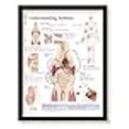 thumbnail image 3 of Understanding Arthritis Framed Medical Educational Poster Informational Diagram Doctors Office School Classroom 22x28 Inches, 3 of 4