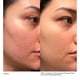 thumbnail image 5 of Sérum Dr. Dennis Gross Advanced Retinol + Ferúlico 30 ml, 5 of 9