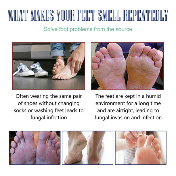 Heel Rescue Foot Cream For Cracked Calloused Or Chapped Skin Heel Exfoliation To Prevent Dry Cracked Calloused Feet