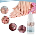 thumbnail image 4 of Suero para tratamiento de hongos en las uñas, esencia reparadora de pies, Gel para eliminación de hongos en las uñas de los pies, crema antiinfección para paroniquia y onicomicosis, 10ML, 4 of 4
