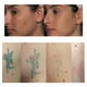 thumbnail image 4 of Pluma para eliminar manchas, Spot Eraser Pro Manchas Cara Eliminación Plasma Pen Facial Machine Tratamientos Para Manchas Piel con gafas, 9 tipos Frecuencia de trabajo(EU) (US) Protección de La Piel Octpeak NO, 4 of 7