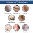 thumbnail image 4 of Crema para eliminar cicatrices de acné, manchas, espinillas, quemaduras, cicatrices quirúrgicas, tratamiento de estrías, reparación, blanqueamiento, hidratación, cuidado de la piel, 4 of 5