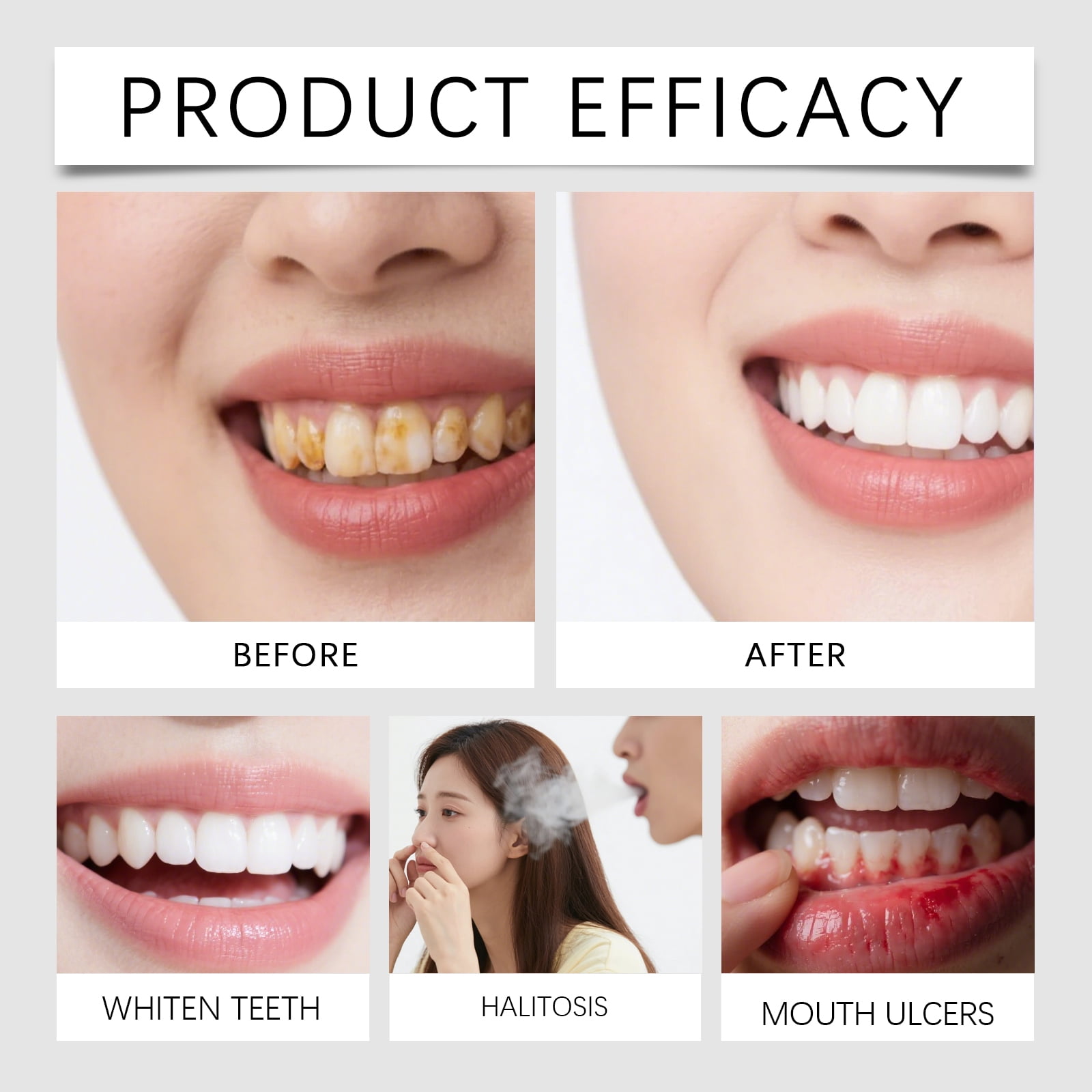 Alvantor Teeth Whitening Gel Pen for Stain Removal, Safe Formula, Long-Lasting, 0.17 fl. oz