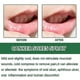 thumbnail image 3 of Mouth Ulcer Spray,Mouth Ulcer Treatment Spray for Adluts,Ulcer Breath Sprays,Canker Sore Treatment,Breath Spray for Bad Breath,Mouth Freshener Spray,H, 3 of 5