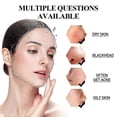 thumbnail image 2 of West&Month Blackhead Cleansing Mud Mask for Pore Cleansing, Removing Blackhead, Acne and Acne Stains, Deeply Cleansing and Moisturizing the Skin, 2 of 4