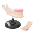 thumbnail image 3 of Raíz Caries Dientes Dientes Enfermedad Dental Anatómico Biológico Dentista Modelo de Enseñanza, 3 of 8