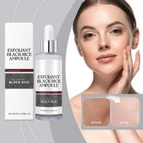 Black Rice Peeling Ampoule, Peel Shot Glow Rice Ampoule Duo, New Soft Rice Exfoliating Face and Body Black Rice Exfoliant for All Skin Types, Korean Skin Care Peeling Ampoule, 3.38 Fl Oz