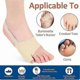 thumbnail image 3 of 2pcs Tailor Bunion Corrector Pads Splint For Bunion Pinky Toe Relief Toe Straightener Little Toe Sep, 3 of 4