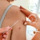 thumbnail image 2 of EeaseMX Kit de 9 extractores de puntos negros y comedones con estuche de almacenamiento., 2 of 8
