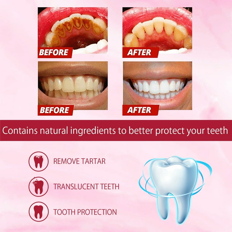 Sp-4 Toothpaste, SP-4 Brightening & Stain Removing Toothpaste
