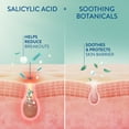 thumbnail image 4 of Cetaphil Gentle Clear Acne Moisturizer With Salicylic Acid, 4 of 6