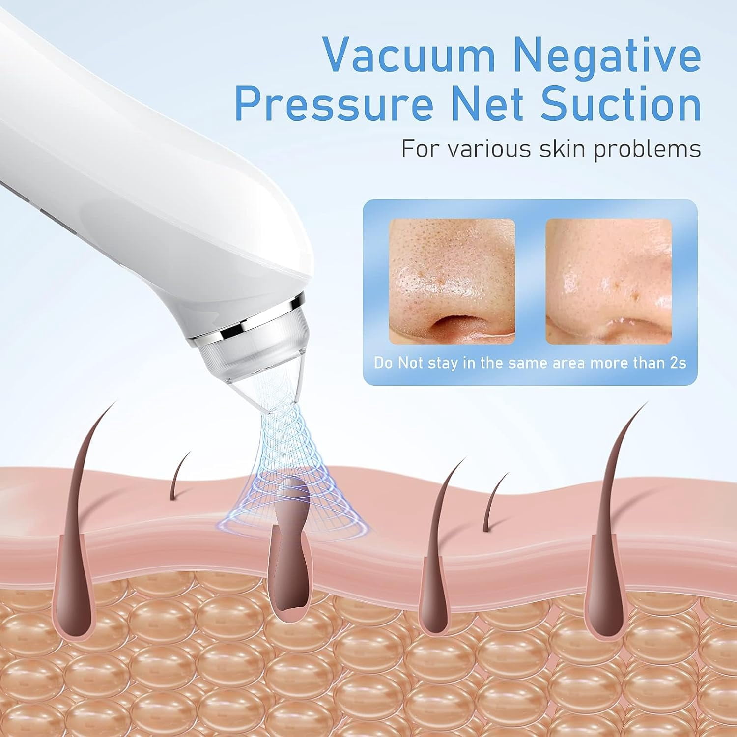 2025  HD Camera Blackhead Vacuum - USB Rechargeable Pore Cleaner with 6 Heads & 3 Power Levels for Deep Cleansing(Orange)
