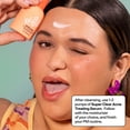 thumbnail image 5 of Bubble Skincare Acne Kit, All Skin Types, 3 Items Included, 5 of 11